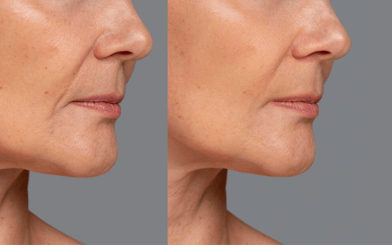 Benefici di Eslow Age 1x29