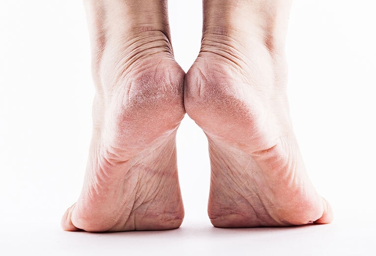 Differenza di Footea 2x49 rispetto ad altri prodotti