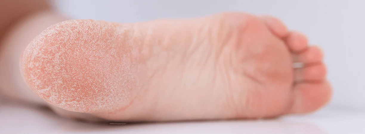 Footea 2x49: Soluzione per piedi secchi e screpolati